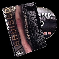 Bruised by Daniel Martin